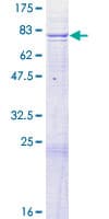 Human ADCK4 Protein (Recombinant GST)
