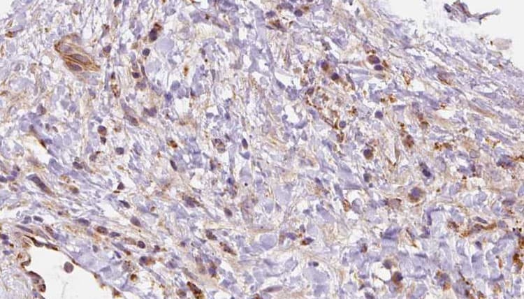 Leukotriene B4 Receptor / BLT1 Antibody