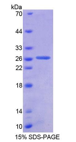 Human AUP1 Protein (Recombinant His-T7)