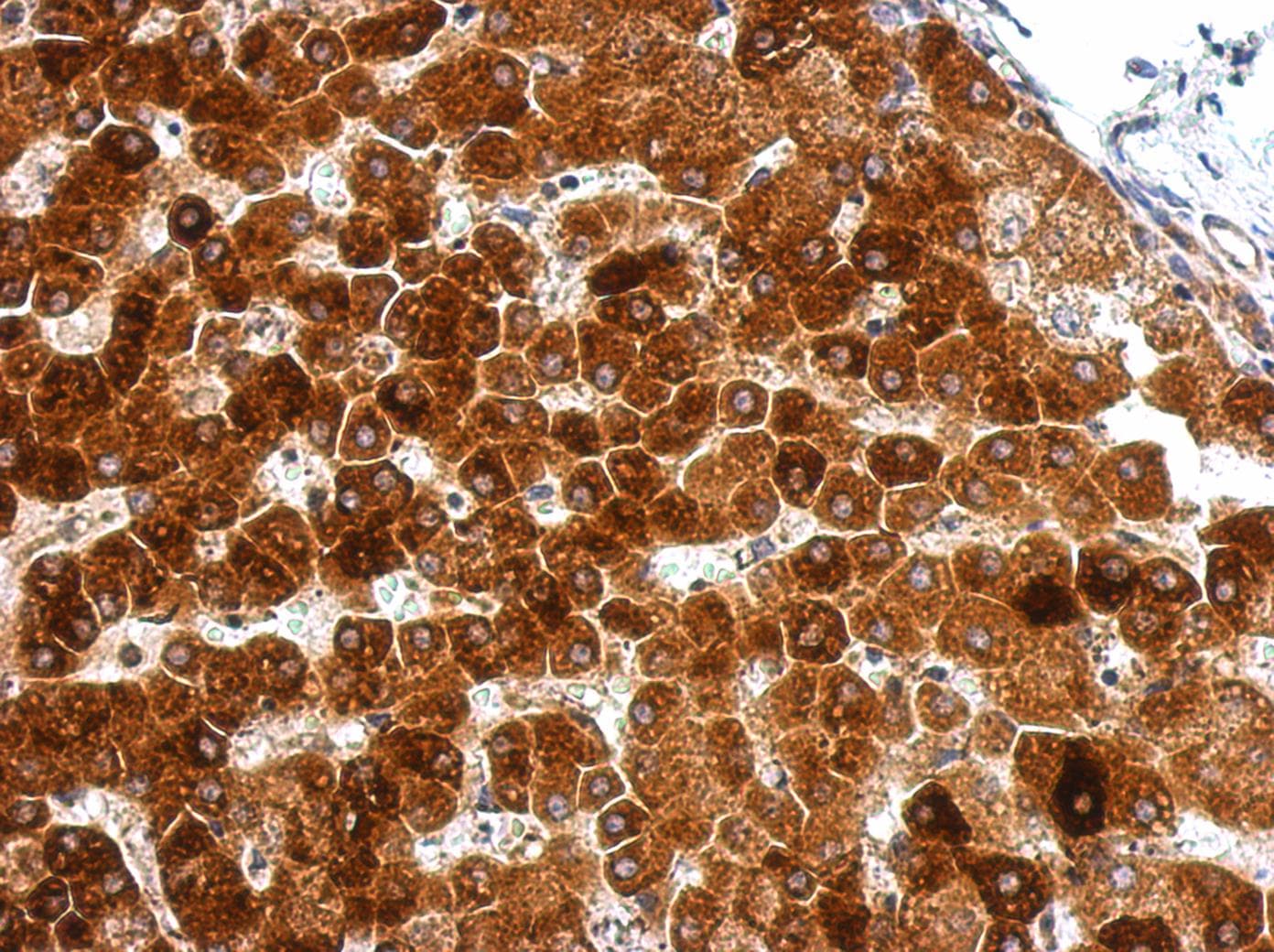 GPAA1 Antibody