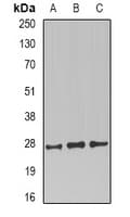Polyclonal Rabbit anti-Human PRNP / PrP / Prion Antibody (WB)