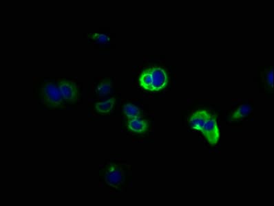DCLK / DCLK1 Antibody