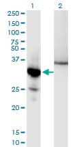 NFKBIA / IKB Alpha / IKBA Antibody (clone 3H4)