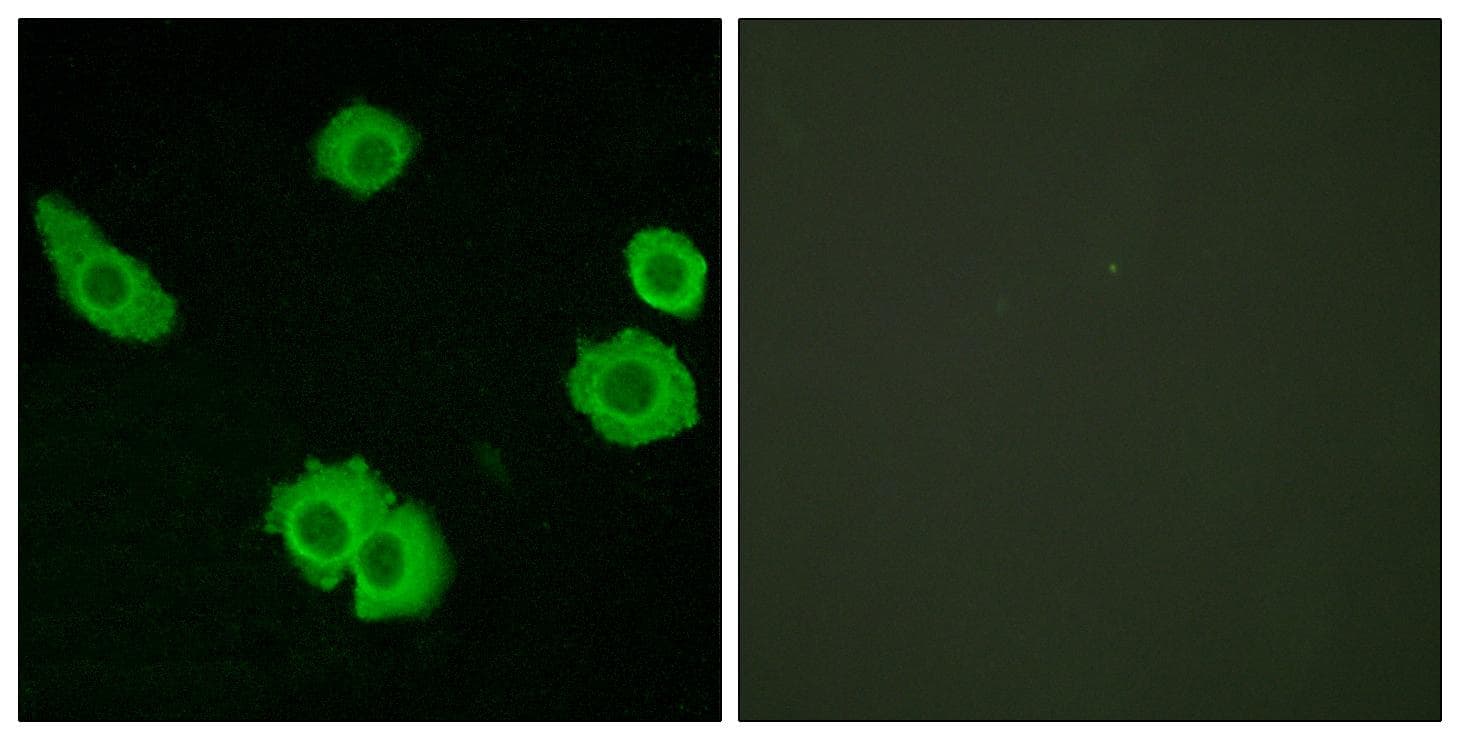 ADGRB3 / BAI3 Antibody