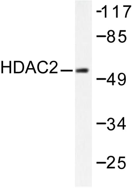 HDAC2 Antibody (Asp388)