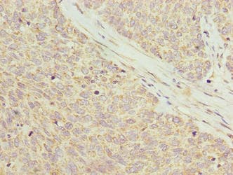 C8orf22 Antibody
