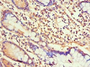 H1F0 Antibody (aa1-194)