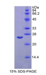 Rat MMP11 Protein (Recombinant His-S)