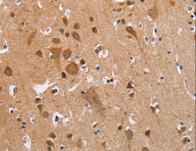 KRT13 / CK13 / Cytokeratin 13 Antibody