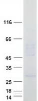 Human TMEM128 Protein (Recombinant Myc-DDK (Flag))