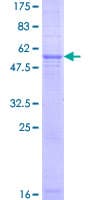 Human TECR / TER Protein (Recombinant GST)