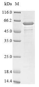 Clostridium botulinum botD Protein (Recombinant 6His-B2M, N-terminus)