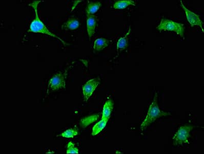 SEPT12 / Septin 12 Antibody