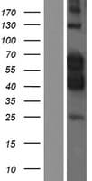 Human CDK16 / PCTAIRE Protein (Over-Expression Lysate Myc-DDK (Flag))