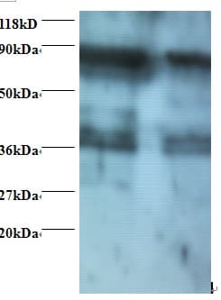 SRM / Spermidine Synthase Antibody (HRP)
