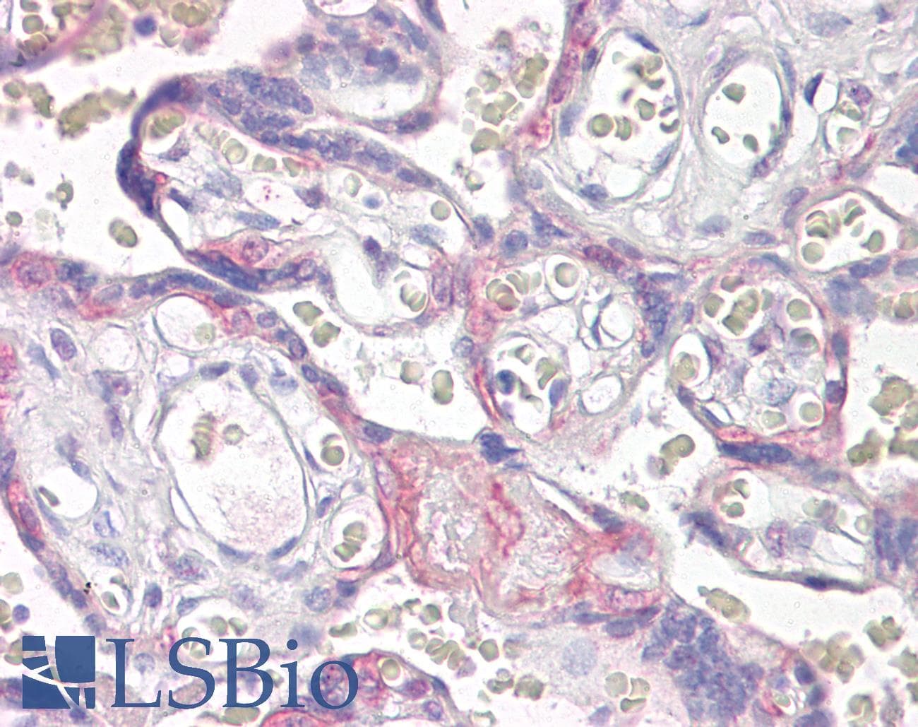 IHC-plus™ VPS41 Antibody (aa499-512)