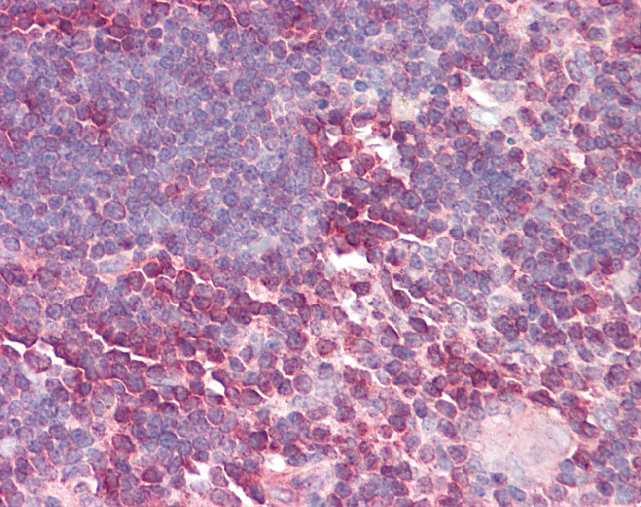 Polyclonal Rabbit anti-Human LBR / Lamin B Receptor Antibody (aa503-552, IHC, WB)