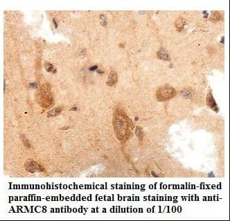 ARMC8 Antibody (aa10-178)