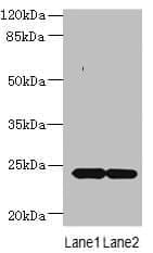 Polyclonal Rabbit anti-Human MRAP2 Antibody (WB)