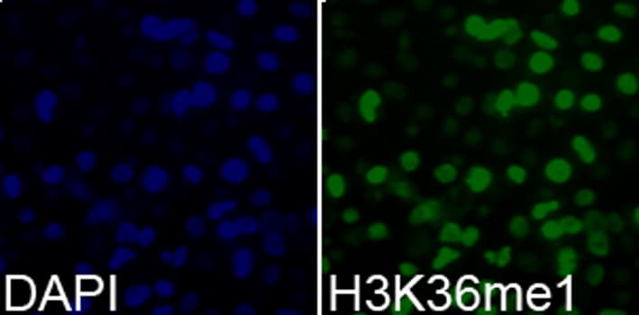 Polyclonal Rabbit anti-Human Histone H3 Antibody (Methyl-Lys36, IHC, IF, WB)