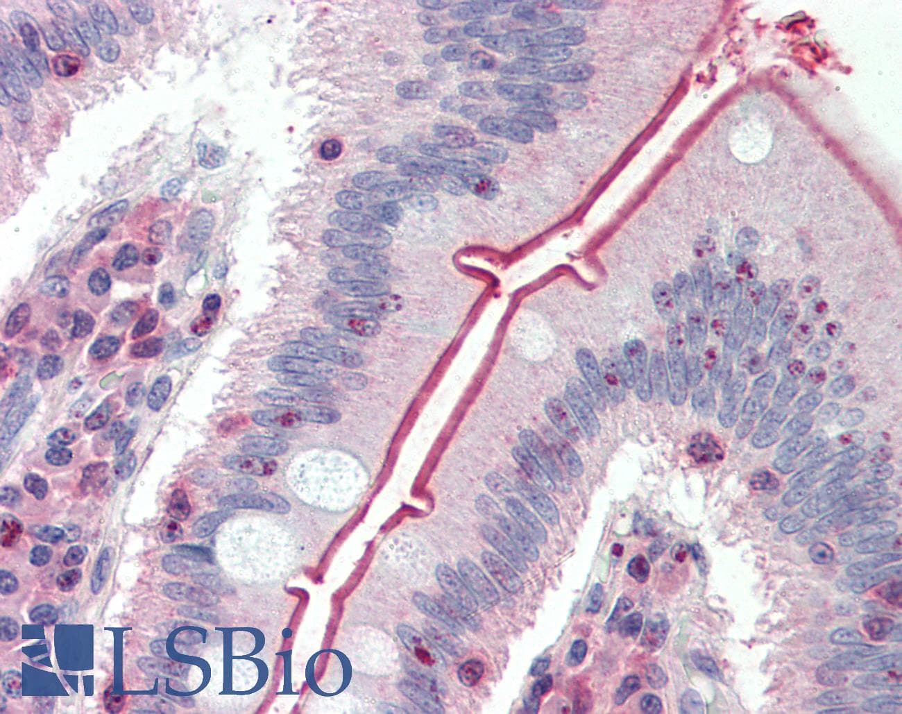 IHC-plus™ Polyclonal Rabbit anti-Human SLC5A1 / SGLT1 Antibody (Internal, IHC)