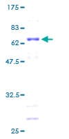Human MAGEA1 / MAGE 1 Protein (Recombinant GST)