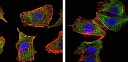 CRTC1 / MECT1 / TORC1 Antibody (clone 1B5)