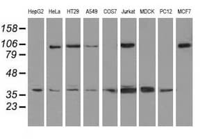 Monoclonal Mouse anti-Human XRCC1 Antibody (clone OTI2H8, WB)