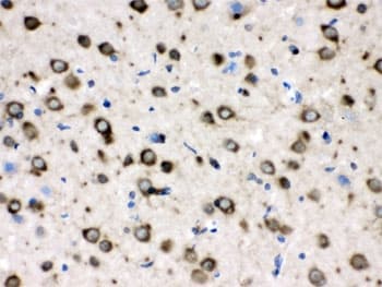 Polyclonal Rabbit anti-Human CCT4 / SRB Antibody (IHC, WB)