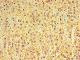 Polyclonal Rabbit anti-Human GPS1 / CSN1 Antibody (aa222-491, IHC)
