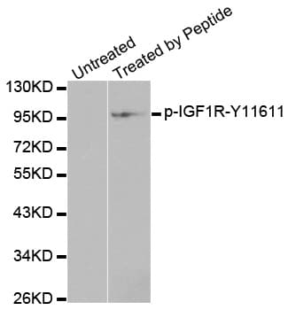 IGF1R / IGF1 Receptor Antibody (phospho-Tyr1161)