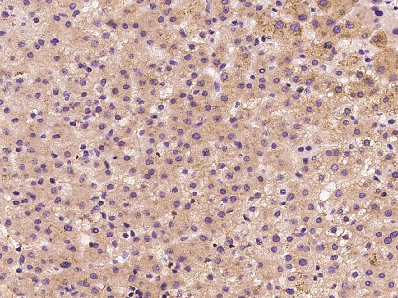 NRP1 / Neuropilin 1 Antibody