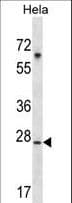 Polyclonal Rabbit anti-Human SRPK1 Antibody (aa1-30, IHC, WB)
