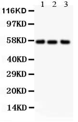 ALPL / Alkaline Phosphatase Antibody (aa31-45)
