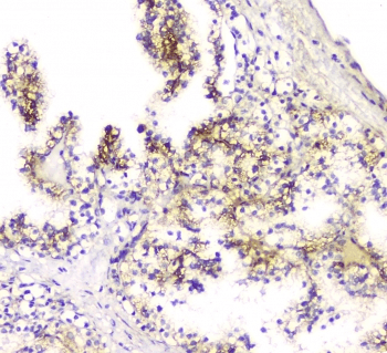 SCN4B Antibody