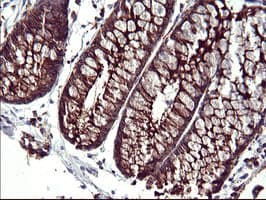 SCAMP2 Antibody (clone OTI1H7)