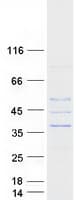 Human AKTIP / FTS Protein (Recombinant Myc-DDK (Flag))