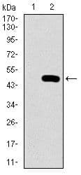 Monoclonal Mouse anti-Human PSAP / Prosaposin Antibody (clone 4D5F4, Amino Acid: 325-524, IHC, IF, WB)