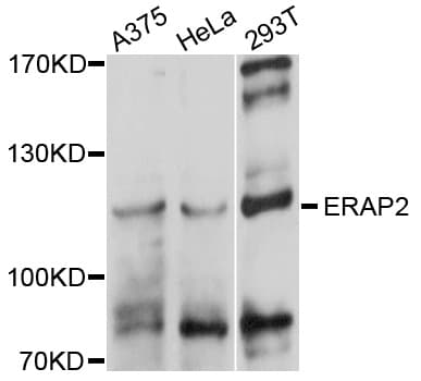 ERAP2 / Aminopeptidase Antibody (AP)