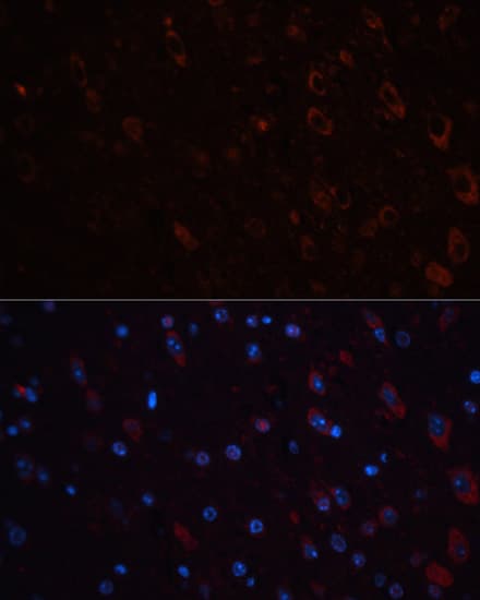 TH / Tyrosine Hydroxylase Antibody