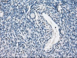 PPP5C Antibody (clone OTI5G5)