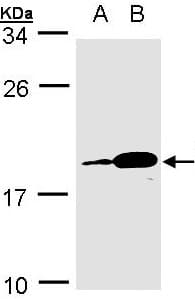 PACAP Antibody (aa1-189)