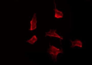 Polyclonal Rabbit anti-Human HCAR2 + HCAR3 / GPR109 Antibody (IF, WB)