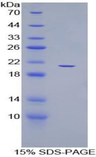 Human ADAMTS12 Protein (Recombinant His)