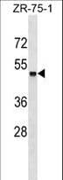 Polyclonal Rabbit anti-Human ZSCAN18 / ZNF447 Antibody (aa194-220, WB)