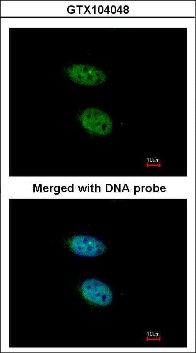 Polyclonal Rabbit anti-Human PRPS2 Antibody (aa1-243, IHC, WB)