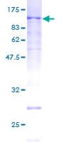 Human MCM5 Protein (Recombinant GST)