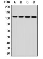 Polyclonal Rabbit anti-Human PCDHA12 Antibody (IHC, WB)