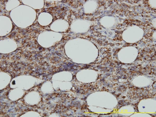 HLA-DMA Antibody (clone 3F12-F11)
