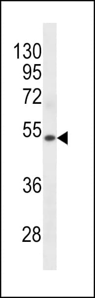 KRT72 / Keratin 72 / K6irs Antibody (aa313-342)